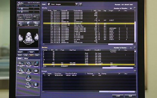 MPR和3D部分介绍