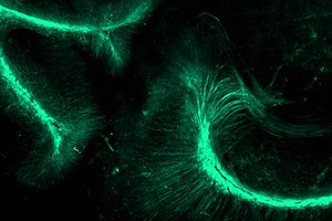 Tissue Clearing Services - LifeCanvas Technologies