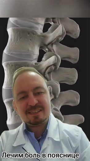 Лечим боль в спине 👍👍👍#больвспине #невролог #минск