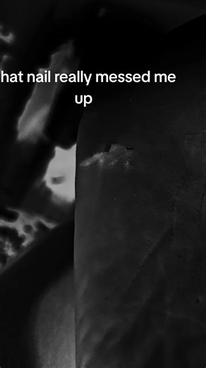 I step on a nail | nail