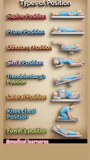 Medical Learners on Instagram: "Common patient positions used in nursing and medical care 🏥 #trending #educational #MedicalPositions #NursingEducation #PatientCare"