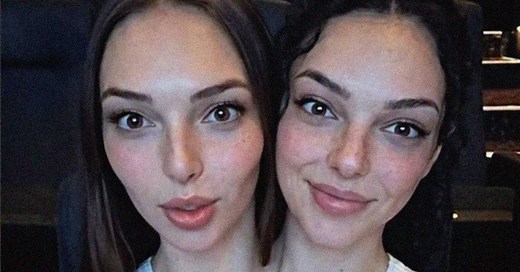 People Are Obsessed With These Conjoined Twins, But Are They Even Real?