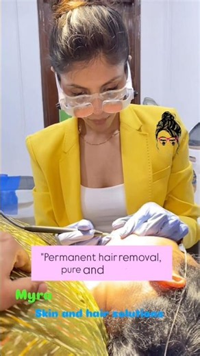 Unwanted facial hair permanently removed with electrolysis by Dr Sonia Mangal #electrolysis #hair