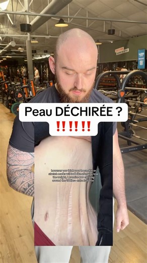 Pas de méthode miracle