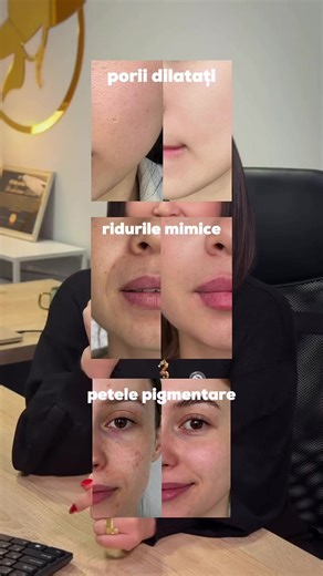 Radiera pentru riduri, pete și pori ✨ K-SECRET SEOUL 1988 Advanced Shot cu 12% retinal încapsulat și microace acționează rapid și profund, estompând imperfecțiunile și uniformizând textura pielii. 💫 Un singur ser pentru rezultate care se văd în timp record. 🛍️ Disponibil la Sublime.