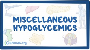 Miscellaneous hypoglycemics: Video, Causes, & Meaning | Osmosis