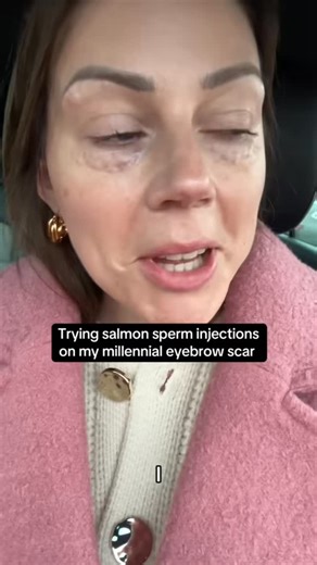 Helen McPherson | Trying salmon sperm injections in my millennial eyebrow scar. #salmonsperm #eyebrowscar #polynucleotides | Instagram