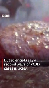 2.2M views · 2.9K reactions | "I gave my daughter something which killed her" - Annie McVey’s teenage daughter died in 2000 from the human form of mad cow disease, vCJD (variant Creutzfeldt-Jakob disease). Now, experts are warning of a second wave of cases. | BBC Lifestyle & Health News | Facebook