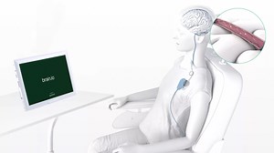 Así funciona Stentrode, el dispositivo que permite controlar el iPad con el pensamiento