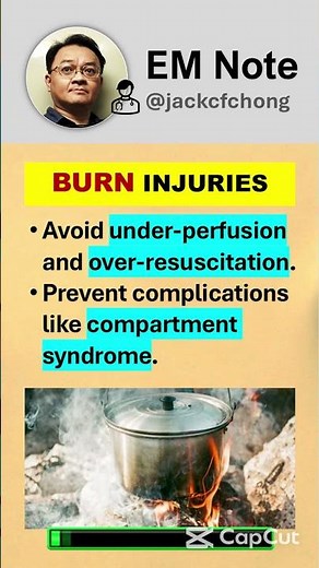 Burn Management