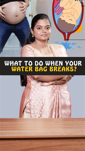 Most of the pregnant women have a doubt regarding their amniotic sac release! They always doubt if labor starts only after amniotic sac release . The answer is No. Only 10-15% of women experience amniotic sac release as an indicator of labor initiation and most of them experience it during labor progress. So if you had an amniotic sac rupture note the 4 factors mentioned in the reel and stay informed... #laborsymptoms #amnioticsac #childbirtheducation #vaginalbirth #amnioticsacrupture [Shobana E