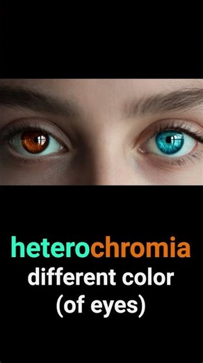English medical term of the day: HETEROCHROMIA