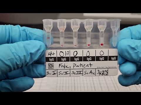 Blood Banking: Gel Antibody Screen