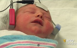 Newborn Hearing Testing - WVU Medicine Health Report
