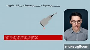Doppler Effect, Doppler Equation and Angle Correction | Ultrasound | Radiology Physics Course #20 on Make a GIF