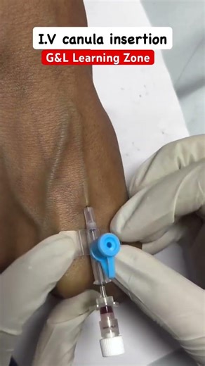 IV Cannula Insertion in 1 Minute 💉