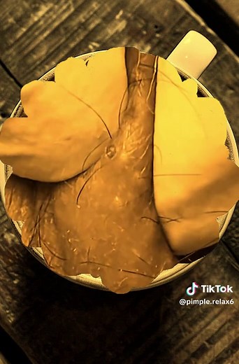 #blackhead #satisfying #tiktok #foryoupage #fypシ゚viral #blackheadextractor #blackheadedpython #relax #asmr
