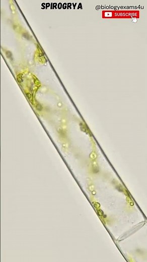 Spirogyra Under Microscope🔬| Filamentous alga | #spirogyra @biologyexams4u