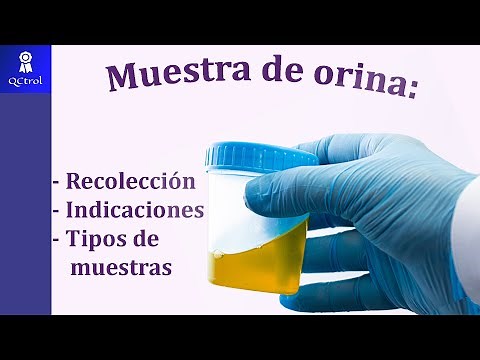 What are the indications for urine samples? Sample types and recommendations