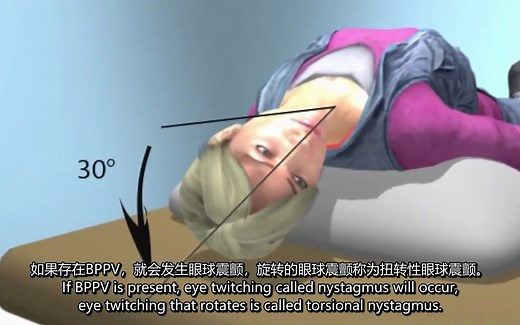 Dix-Hallpike试验_诊断良性阵发性位置性眩晕(BPPV)