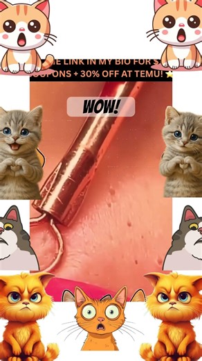 Insane Pimple Popping!!!