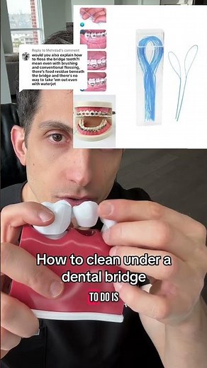 How to clean under a dental bridge