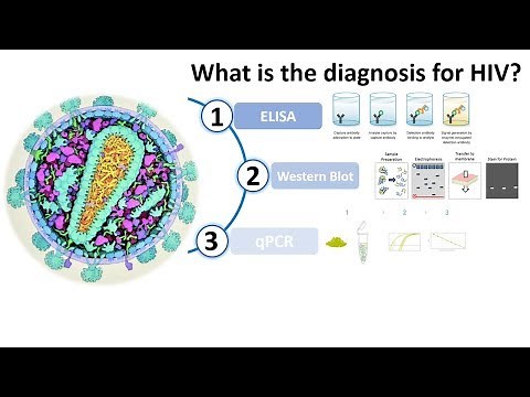 Diagnosis of HIV AIDS