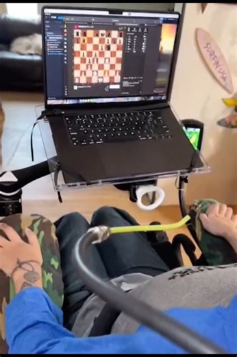25K views · 217 reactions | BREAKING: First Neuralink human patient controls cursor, plays chess using brain power alone  Find out more at https://ie.social/VwMO8  #engineering | Interesting Engineering | Facebook