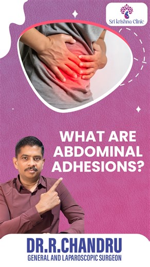 Dr R Chandru on Instagram: "Did you know that scar tissue inside the abdomen can cause organs to stick together? This condition is called abdominal adhesion. It often develops after surgery or infection and may not show symptoms in many people. However, in some cases, it can lead to pain, bloating, constipation, or even intestinal blockage. Watch this video to understand the causes, symptoms, and when you should seek medical help. Early awareness can prevent serious complications. #abdominaladhe