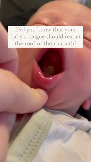 Let me tell you about a little magic trick!This is the sleeping tongue posture hold. See how the mouth was open and the tongue was resting on the bottom of the mouth? This can happen due to a tongue tie. Meaning that the tongue is too restricted and therefore can’t go to that resting position at the roof of the mouth.Why is this important? Well ideally we want the tongue at the roof of the mouth for two reasons; -optimal breathing out of the nose rather than mouth-shaping of the palate