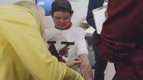 Historic face and hand transplant recipient from NJ steps out for first time