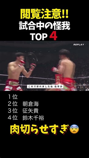 閲覧注意!!試合中の怪我 TOP４ #shorts #格闘技 #k1 #rizin #breakingdown