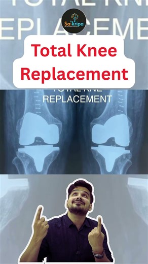 Knee Replacement X-Ray Transformation 😳 | Before vs After #Shorts