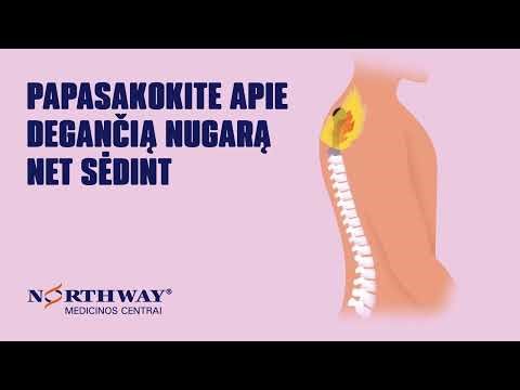 Nugaros skausmas. Mums tai ne smulkmena