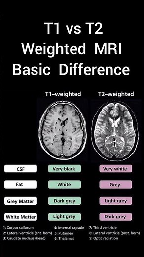 T1 vs T2 mri difference #radiographer#radiology#mri#anatomy