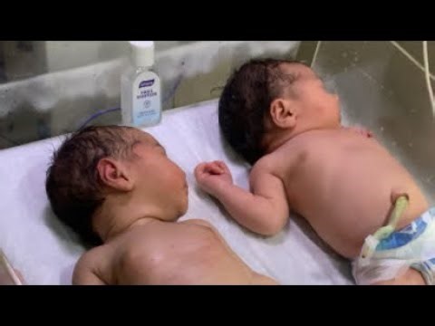 NICU Miracles – Real Baby Recoveries are these are cute