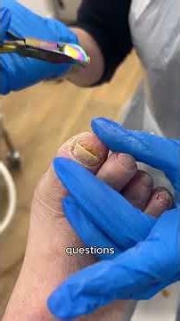 Can you spot what's wrong with this? | Podiatrist explains #podiatry #podiatrist #fungalinfection