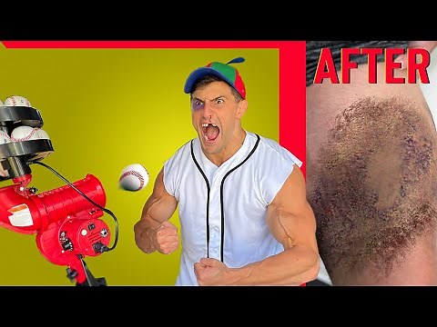Creating the WORST BASEBALL INJURY of all Time | Bodybuilder VS Pitching Machine Experiment