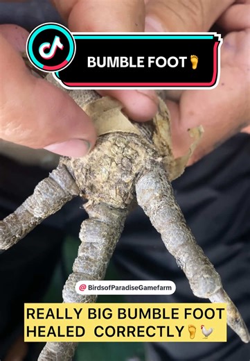 How to correctly treat bumblefoot in chickens. This video shows the after results, once the foot has fully healed. If you’re interested in seeing a before video where I clean, disinfect, and dress the bumblefoot using a product that worked really well for me, leave a comment below. There are many different ways to treat and remove bumblefoot, and honestly, I’ve tried them all. This method is the only one that consistently worked best for me. That said, if you have a technique that’s worked for y