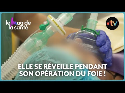 Anesthésie générale : peut-on se réveiller pendant une chirurgie ?