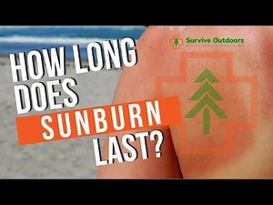 How Long Does Sunburn Last? - Pain and Redness