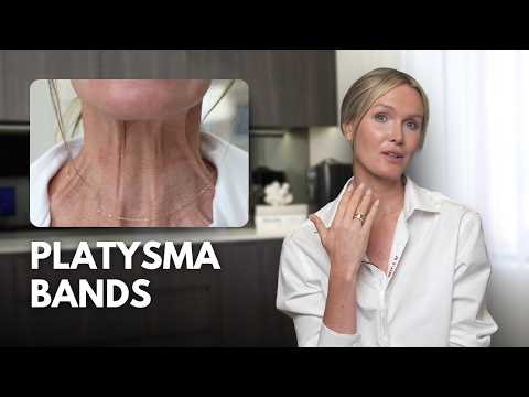 Platysma Bands + Neck Lines Explained by a Cosmetic Nurse