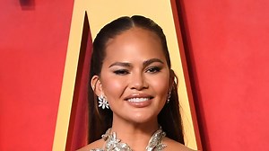 Chrissy Teigen reveals 'boob lift scars' as she poses in sheer dress