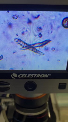 Demodectic mange in dogs 🐕🐾 This is caused by a parasitic mite (Demodex canis or Demodex injal) that lives in the hair follicles of dogs. Under the microscope, this mite is shaped like a cigar with eight legs.#fyp #fypシ #vetmed #vettechtok #vettechlife #foryourpage #pets #vet #vetlife #dogs