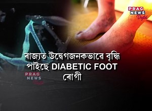 806K views · 6.5K reactions |  ৰাজ্যত উদ্বেগজনকভাৱে বৃদ্ধি পাইছে...