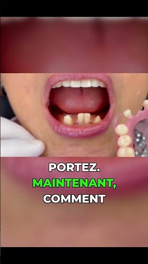 Ce que vous ignoriez sur les prothèses flexibles #dentures #comfort