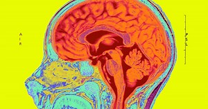 Can We Create An Artificial Brain?