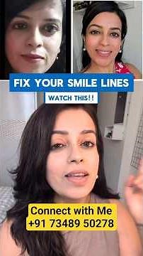Your Smile Lines Naturally! (Step-by-Step Fascia Release) #FaceYoga #AntiAging #SmileLines