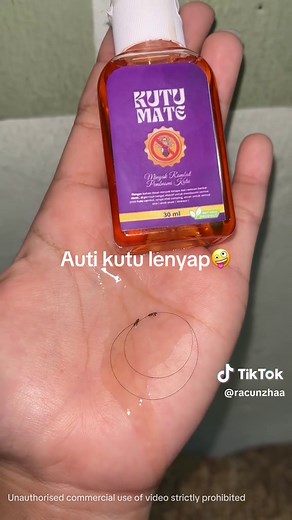 Obat Kutu Rambut Ampuh dan Cara Menghilangkannya