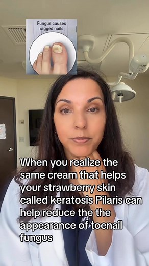 And that cream is @cetaphil rough and bumpy or @amlactin apply to nails twice a day to soften them! #toenailfungus #fungus #toenail | Dr. Leela Athalye